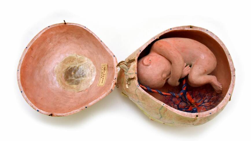 Fœtus